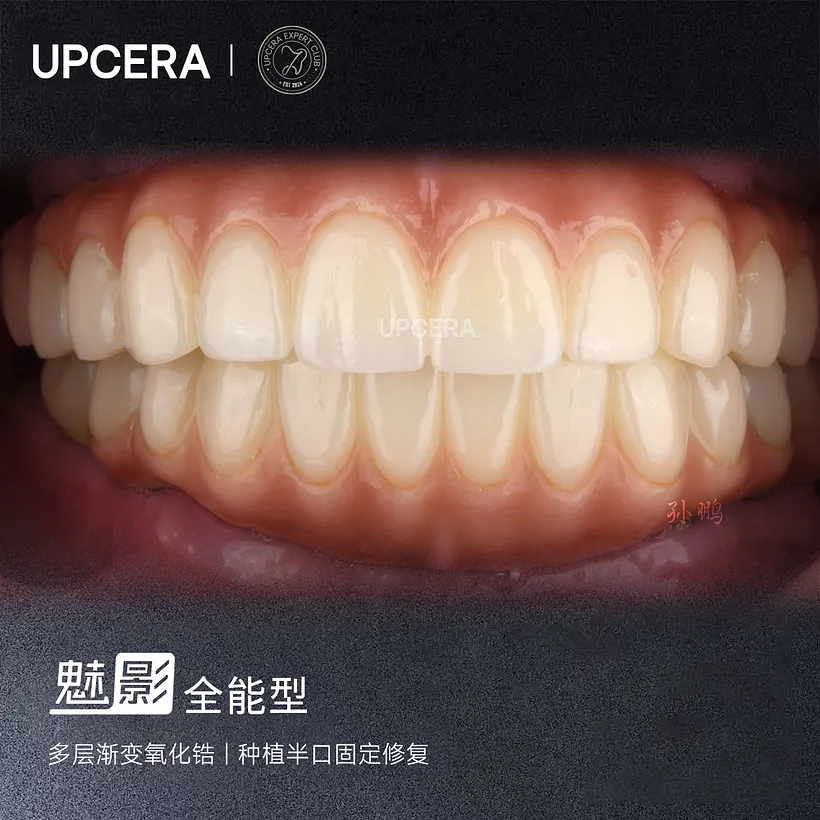 3.webp