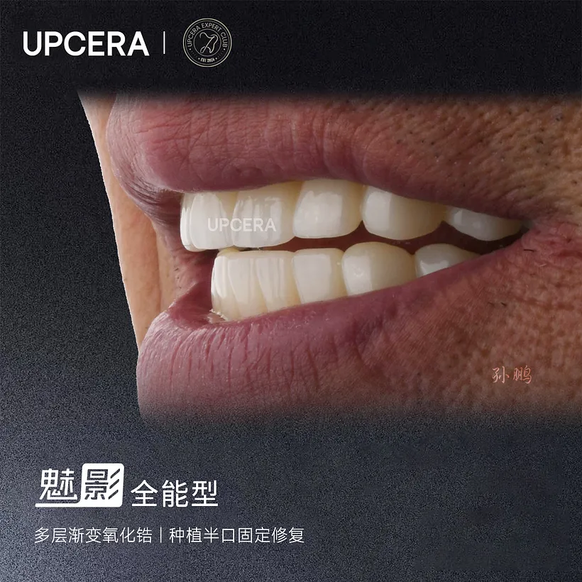 5.webp